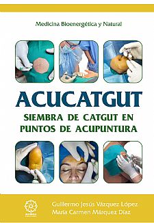 ACUCATGUT Siembra de Catgut en puntos de acupuntura