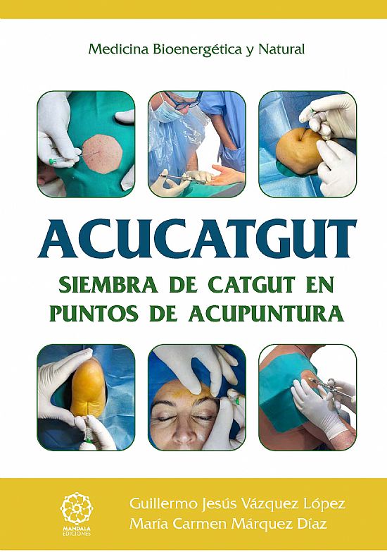 ACUCATGUT Siembra de Catgut en puntos de acupuntura