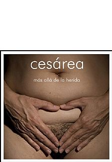 Cesrea